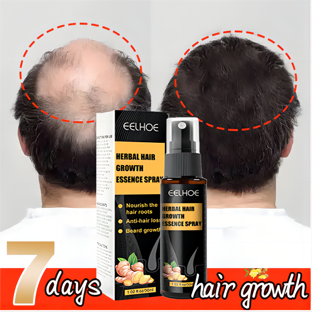 【effective In 7 Days】hair Grower Spray Original Minoxidil Hair Growth Fast Long Hair Serum 9808