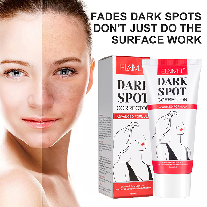ELAIMEI speckle removal cream whitening skin fade spots chloasma
