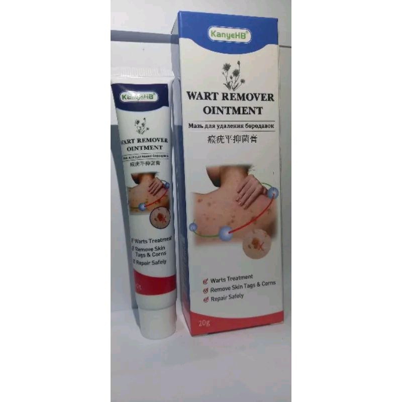 Quickly Remove Wartswart Remover Ointment Wart Treatment Skin Tags