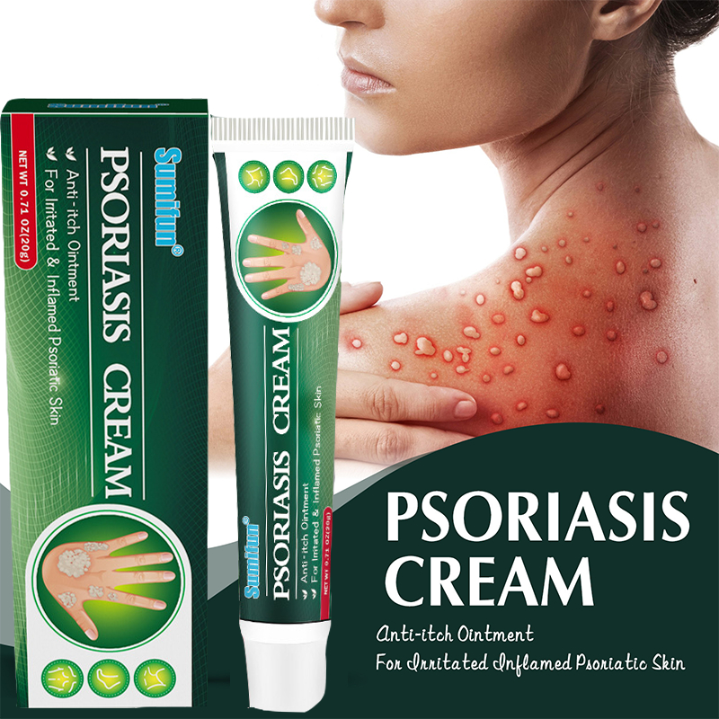 Eczema Treatment Anti Eczema Cream Anti Fungal Ointment Ringworm and