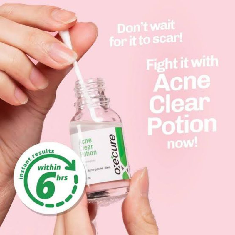 Oxecure Acne Clear Potion 15ml Expiry Aug 252025 Shopee Philippines 1334