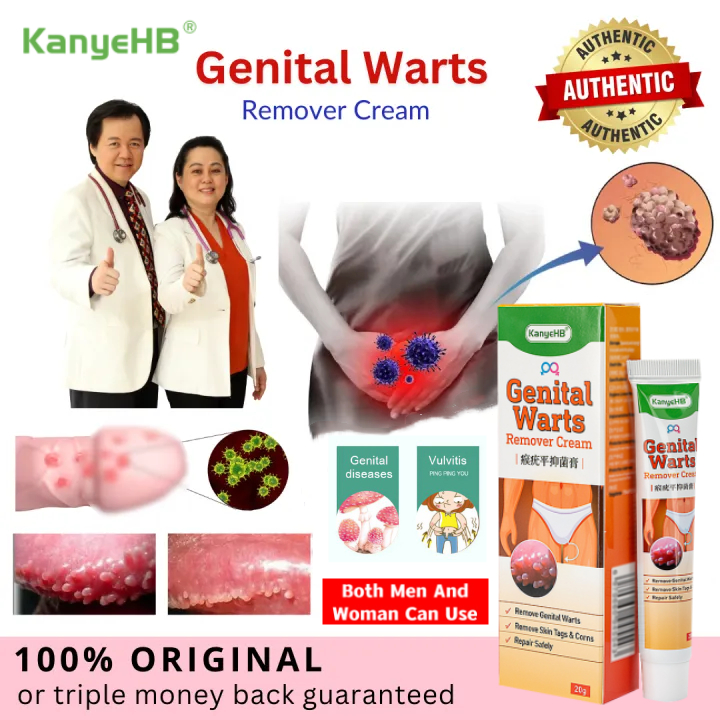 Kanyehb Genital Warts Remover Original Ointment Skin Tag Remover Cream Effective Remover Foot 0164