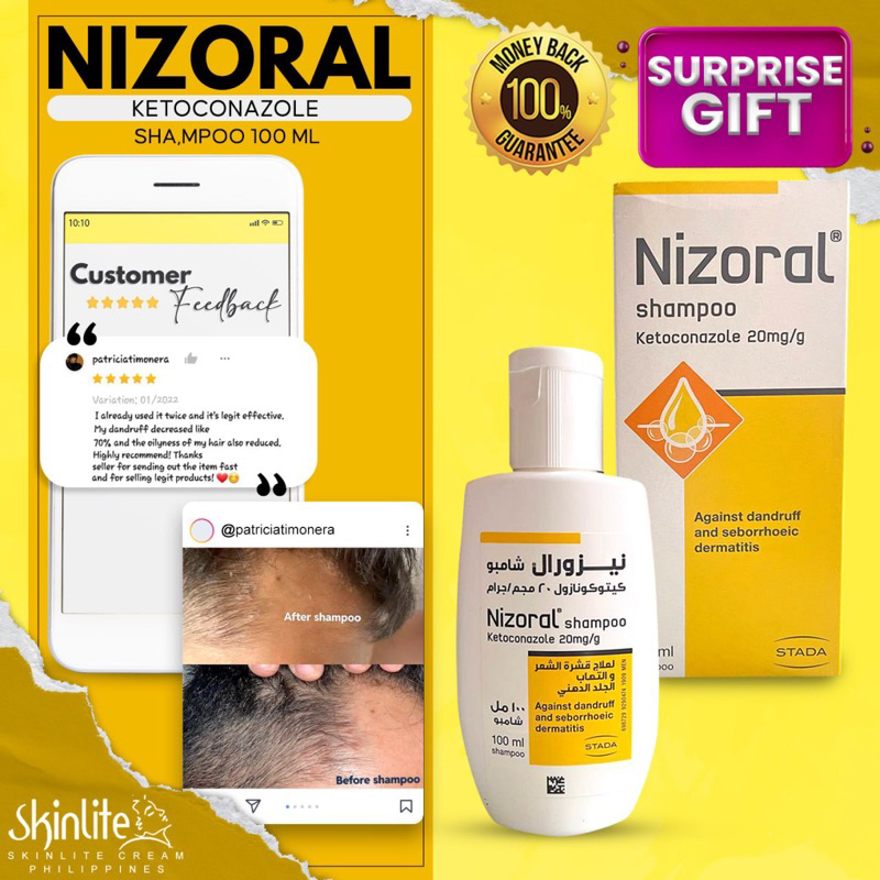 EXP DATE 11/2024 Nizoral Shampoo Ketoconazole 20mg 100ML Shopee