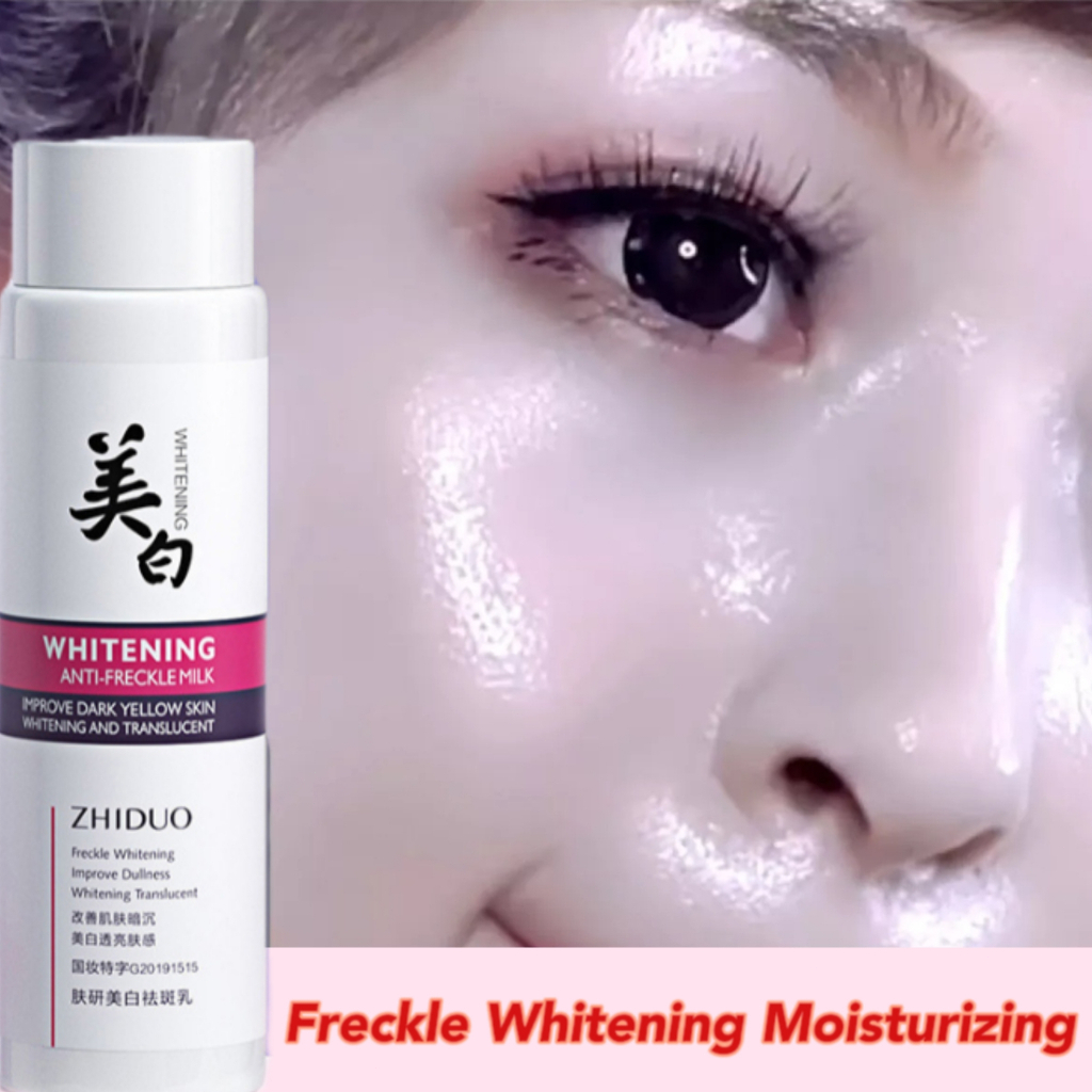 Ml Melasma Cream Lotion Pekas Remover Whitening Freckle Cream Dark Spot Remover Whitening