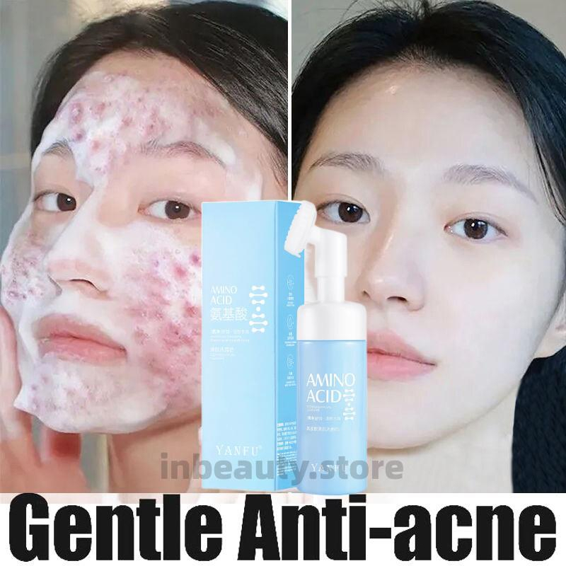 Amino Acid Deep Facial Cleanser Gentle Skin Cleanser Anti Pimple Acne