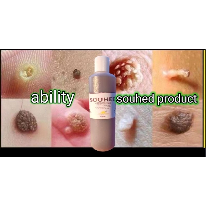 SOUHED PRODUCT 250ML | KULUGO REMOVAL KALYO REMOVAL AN AN BUNI ALIPUNGA ...