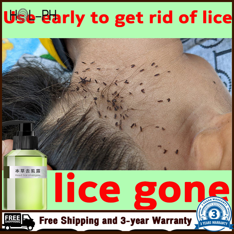 100mL lice remover shampoo Licealiz Head Lice Treatment Shampoo ...