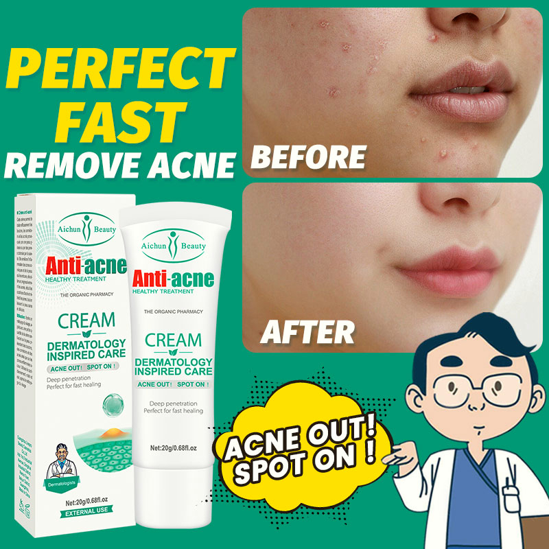 Acne remover cream Pimple eraser Pimple marks remover Pore minimizer
