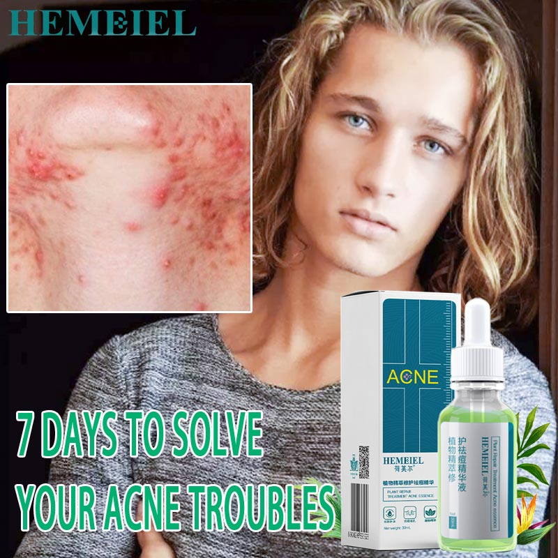 HEMEIEL Pimple Marks Acne Remover/Adapalene Clindamycin/Acne Treatment