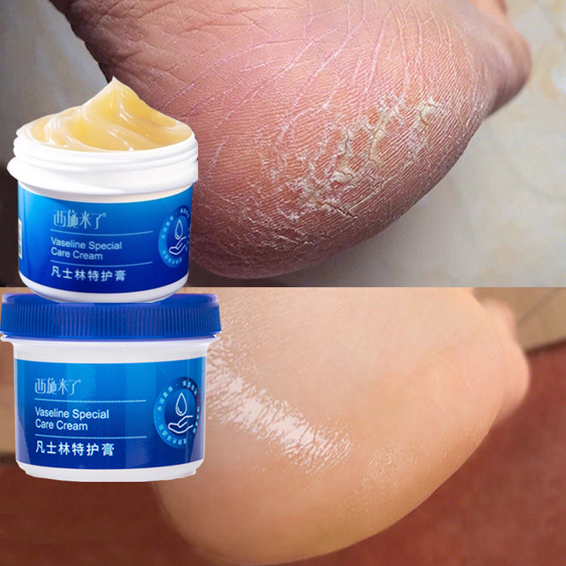 Vaseline Anti Cracking Foot Cream Moisturizing Cream For Dry Anti