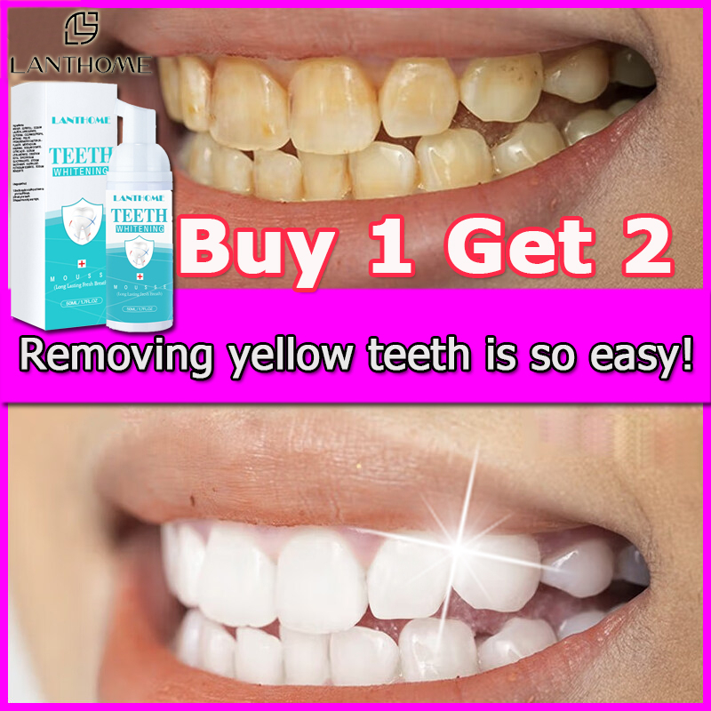 LANTHOME teeth whitening teeth cleaner tartar teeth whitening