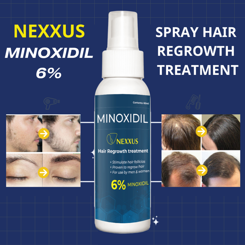 NEXXUS MINOXIDIL Strands 6% Minoxidil Topical Solution (60ml per bottle)  Hair Grower beard Grower | Shopee Philippines