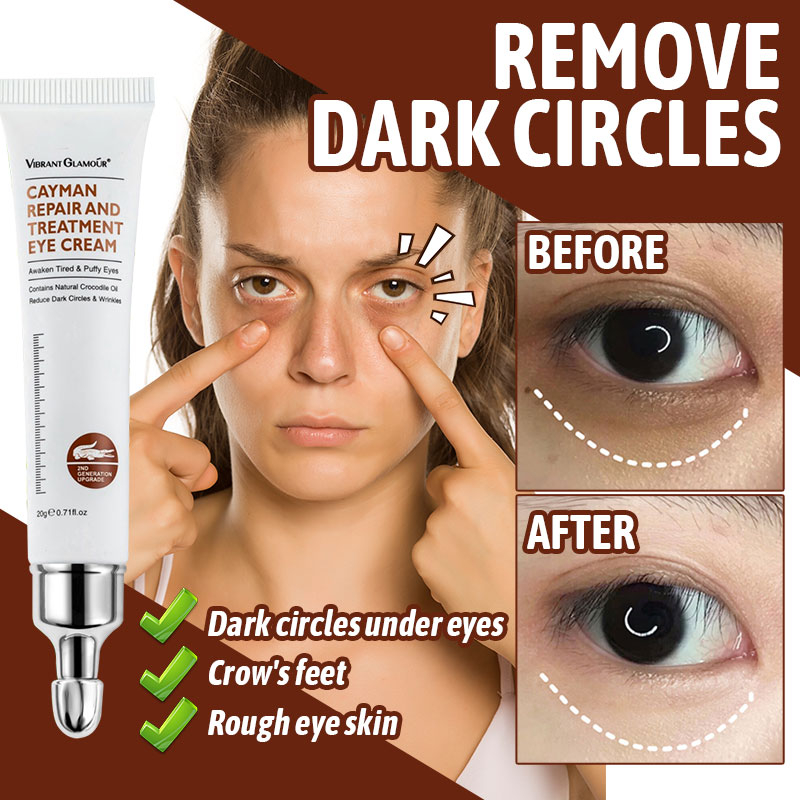 Eyebag Remover Cream Retinol Eye Cream for dark circle eyebags remover