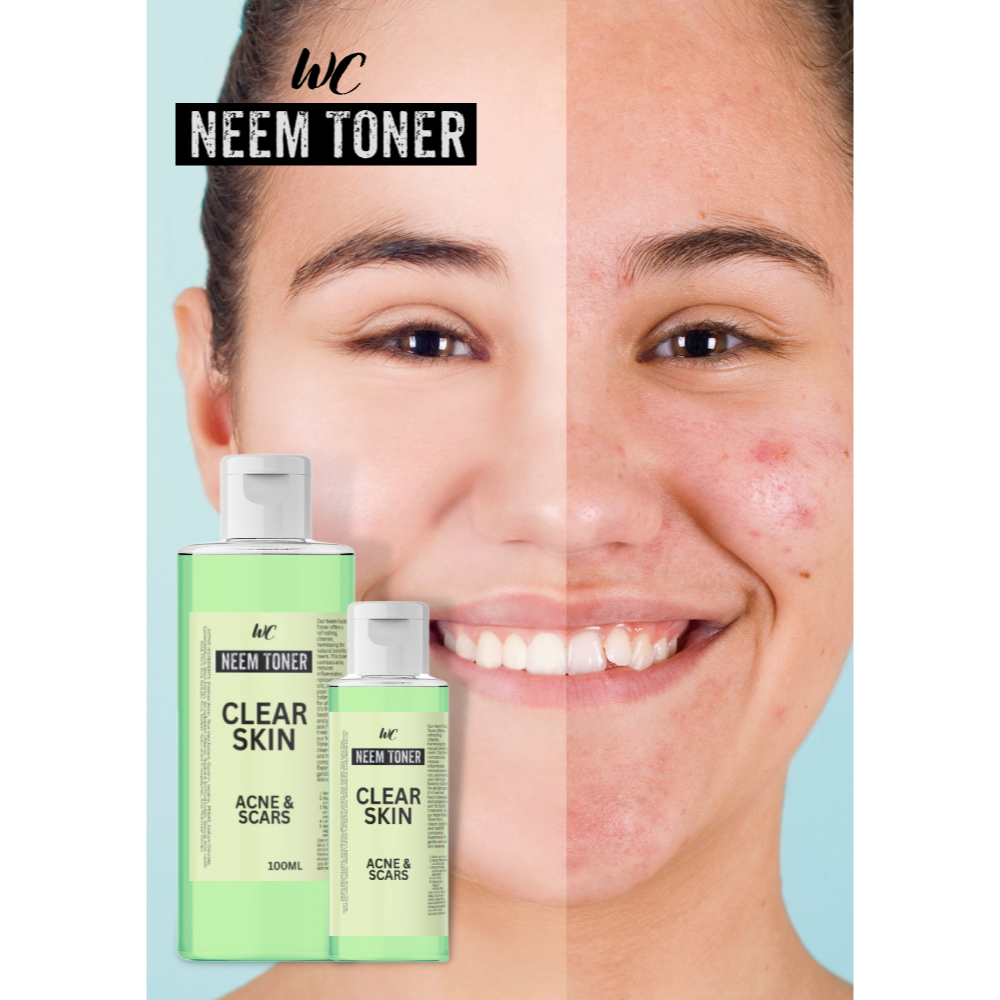 Acne Care Neem Miracle Face Toner Neem Extract Shopee Philippines