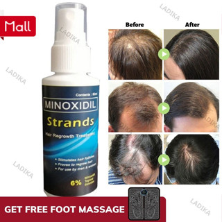 minoxidil - Best Prices and Online Promos - Jan 2024 | Shopee Philippines