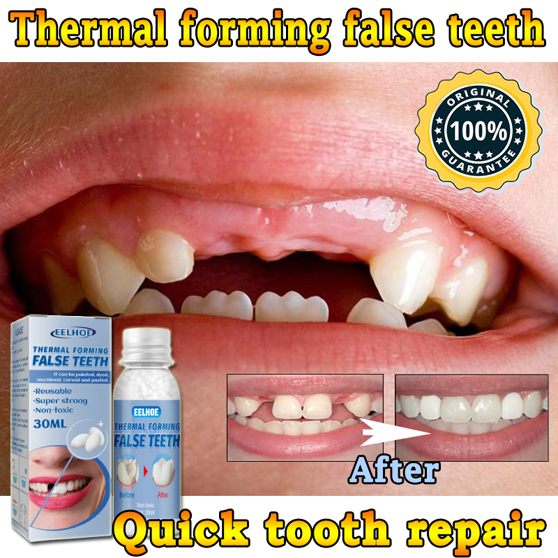 30ML Temporary Tooth Repair Kit Filling Teeth Gaps Moldable False Teeth