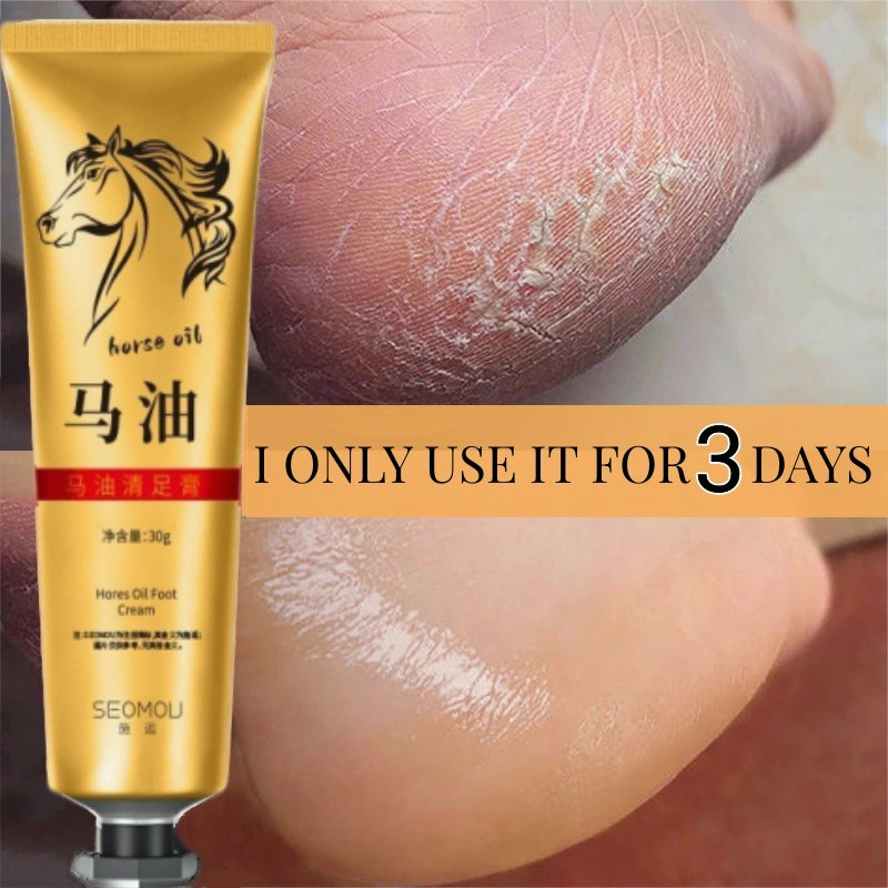 30g Horse Oil Callus Remover Foot Care Cream For Cracks And Dry Cracked