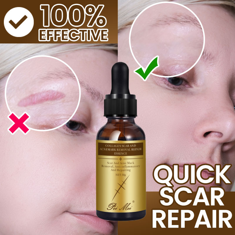 Scar Remover Cream Scars Repair Stretch Marks Pregnancy Scars Scalded