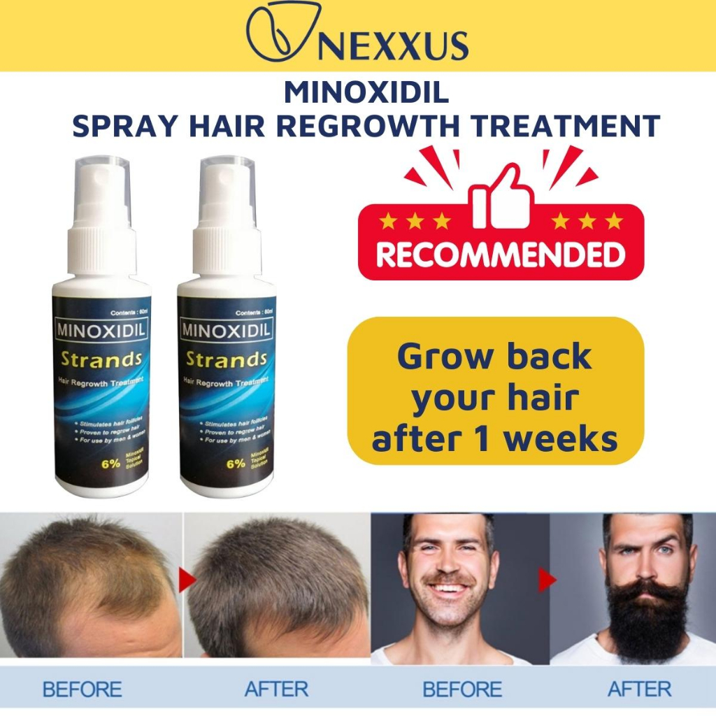 Nexxus Minoxidil Strands 6% Anti Hair Loss Treatment Hair Grower beard ...