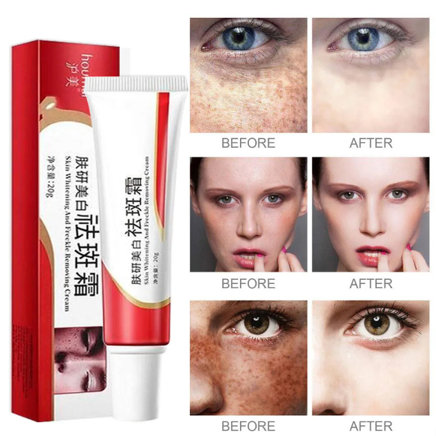 Pekas Remover Effective Melasma Cream Anti Freckle Collagen Original Skin Whitening Moisturizer 8743