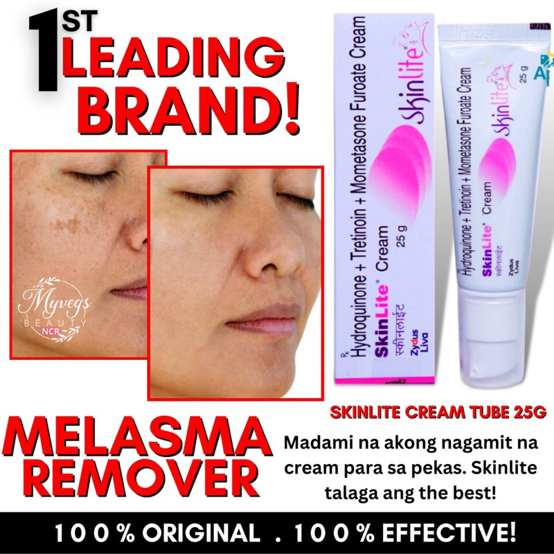 PREMIUM SKINlite MELASMA WHITENING CREAM25G ANTI AGING, ANTI MELASMA