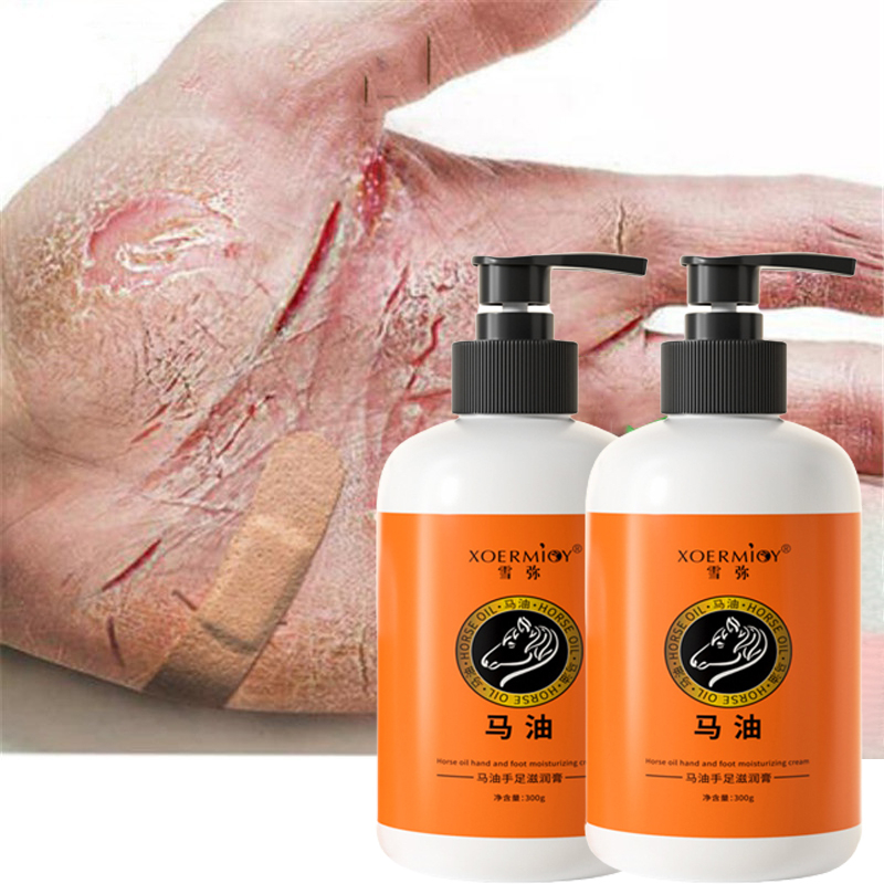 300g Horse Oil Callus Remover Anti Cracking Hand Foot Cream Heel Repair