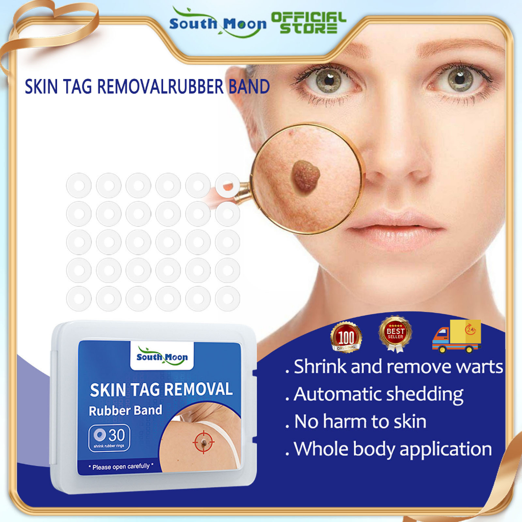 South Moon Warts Remover Skin Tag Remover Band Warts Removal Rubber Remover Kit With Cleansing