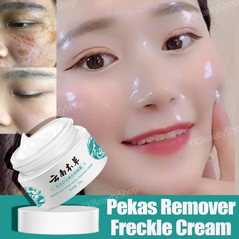 Pekas Remover Melasma Cream Whitening Freckle Cream Dark Spots Brighten ...