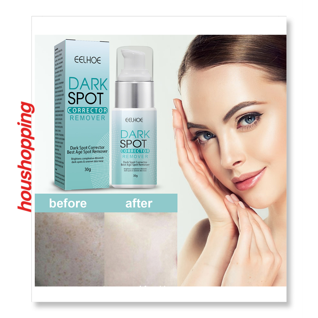 EELHOE Dark Spot Corrector Best Age Spot Remover 30g Shopee Philippines