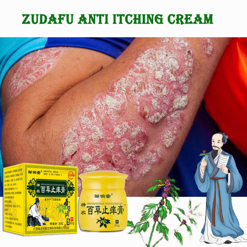 50g anti itch cream/anti itch lotion/anti itch ointment/antibacterial