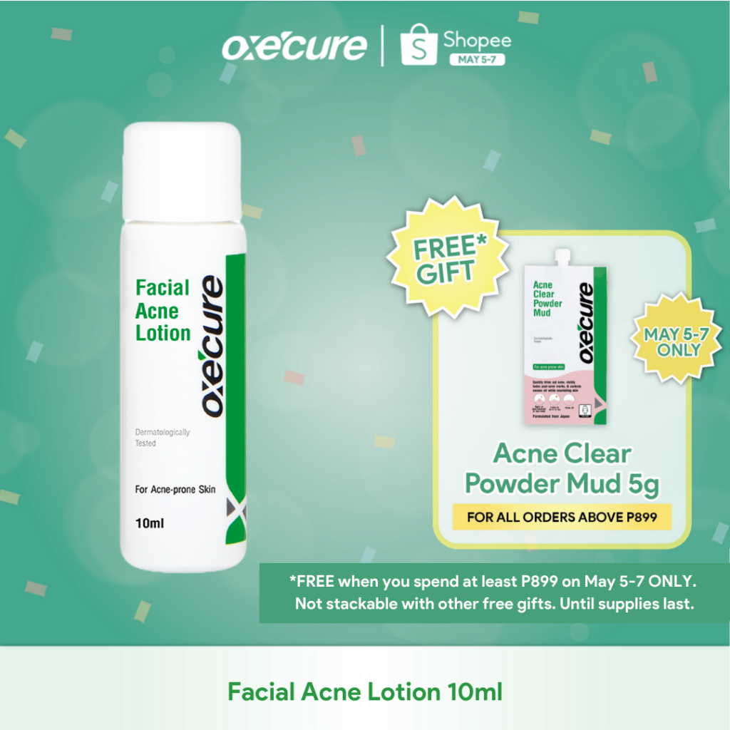 Oxecure Facial Acne Lotion 10mL Shopee Philippines