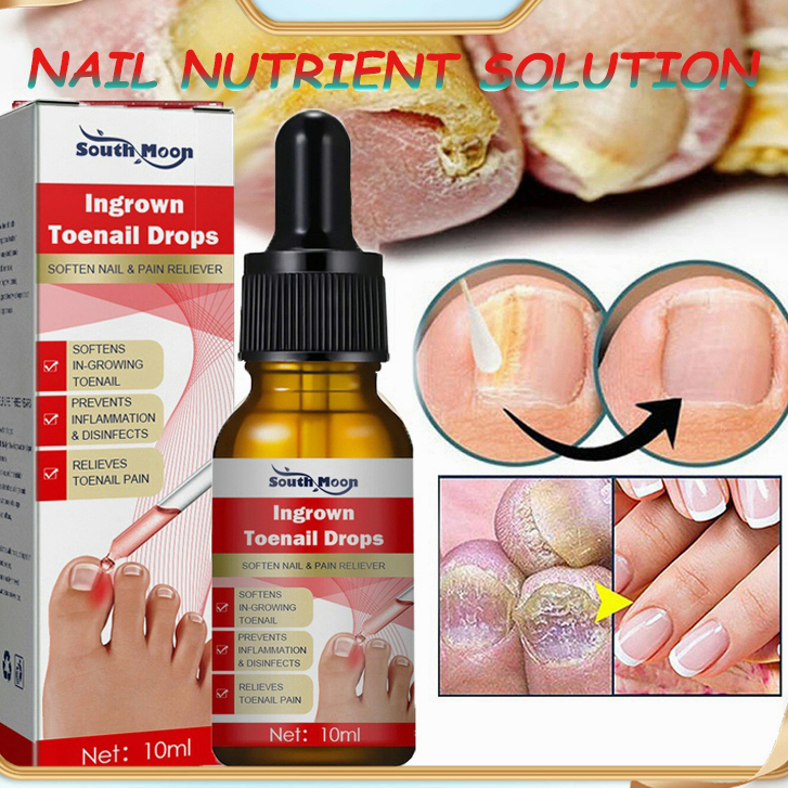 Nail Fungus Treatment Ingrown Toenail Drops original Stop Fungal Growth Essential Oil Grey Nail