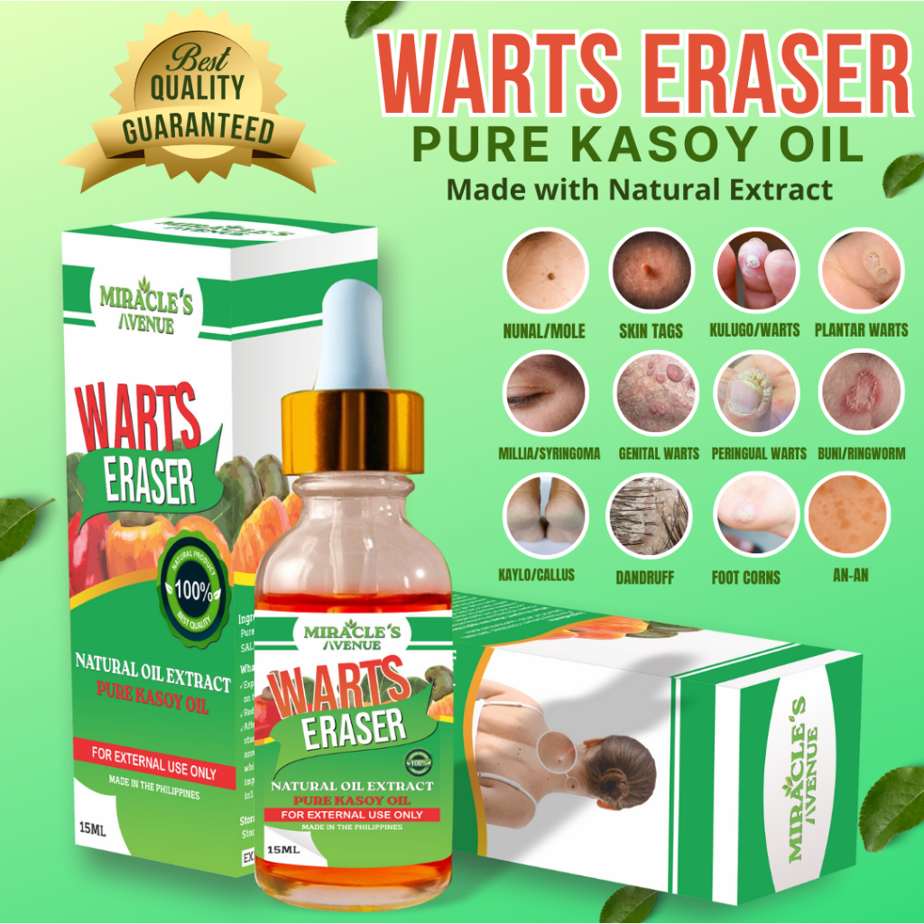 Organic Pure Kasoy Oil Warts Eraser 15ml Effective Remover of Mole Skin ...
