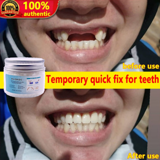 Shop dentures glue for Sale on Shopee Philippines