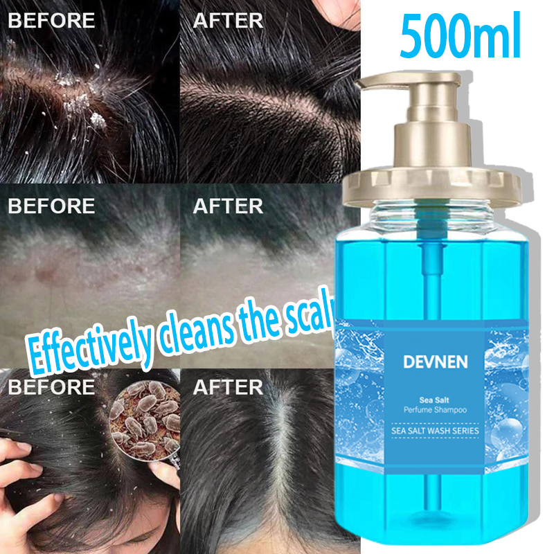 DEVNEN 500ML Sea Salt Shampoo Anti Dandruff Shampoo Hair Treatment