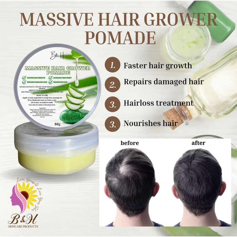 B&H MASSIVE HAIR GROWER POMADE (50g) Shopee Philippines