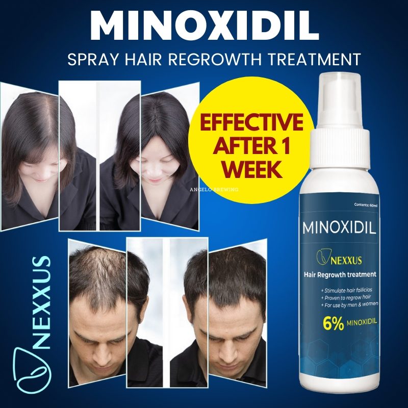 Minoxidil Nexxus 6% Minoxidil Topical Solution Hair Grower Beard Grower ...