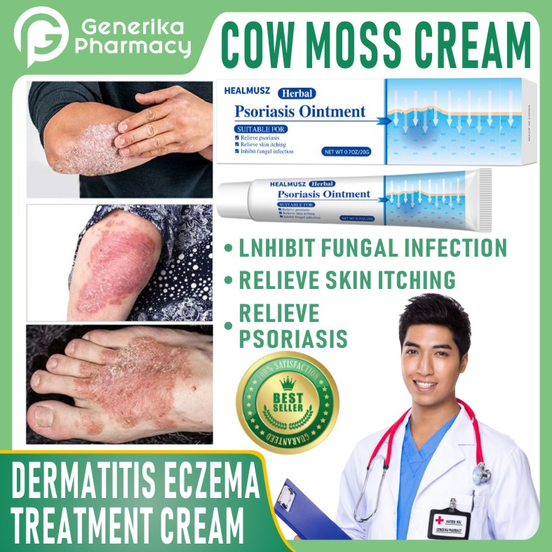 Psoriasis Antibacterial Cream Eczema Rash Treatment Dermatitis