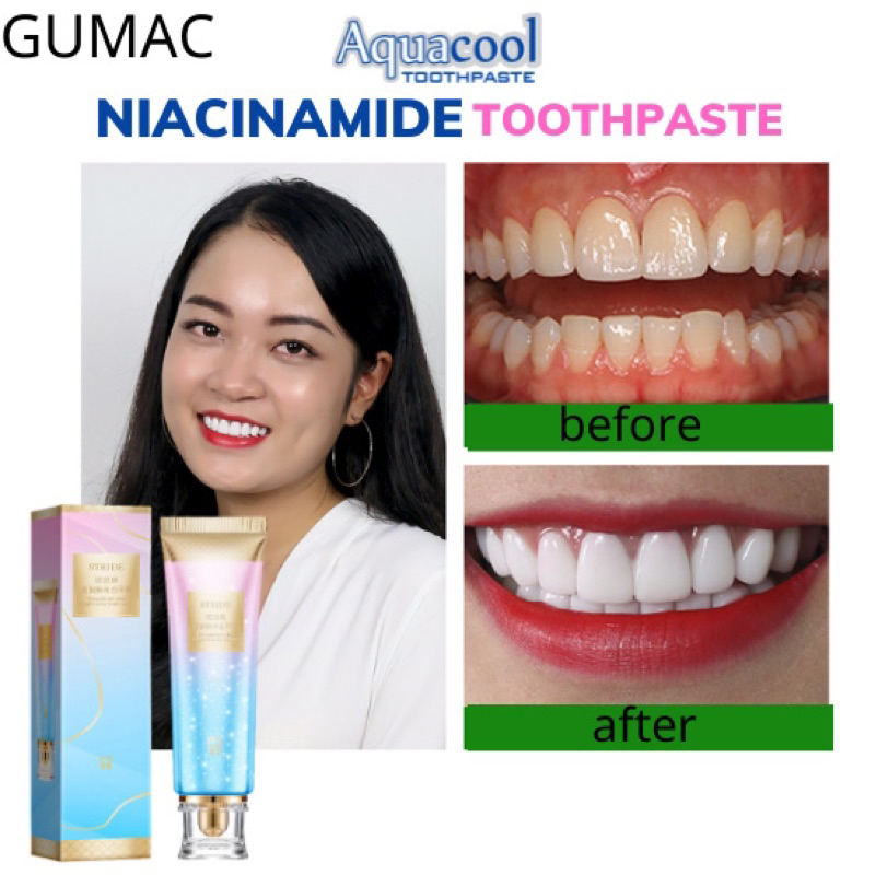 Fast Limit Sale/ AQUACOOL Niacinamide Toothpaste Whitening Teeth Clean ...