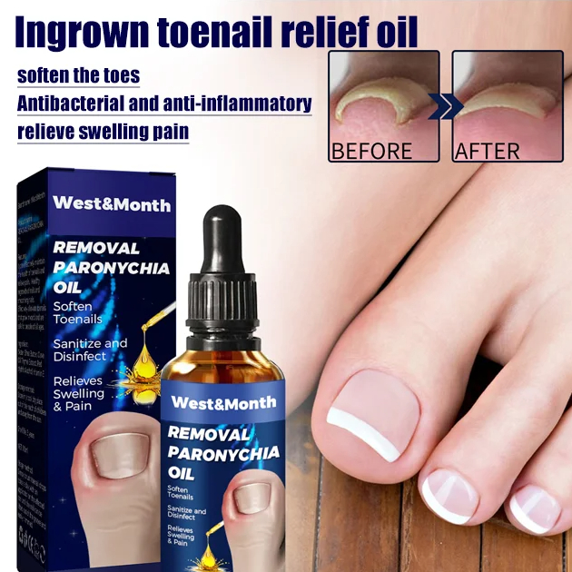 Ingrown Toenail Soothing Oil Repairing Ingrown Toenails Onychomycosis