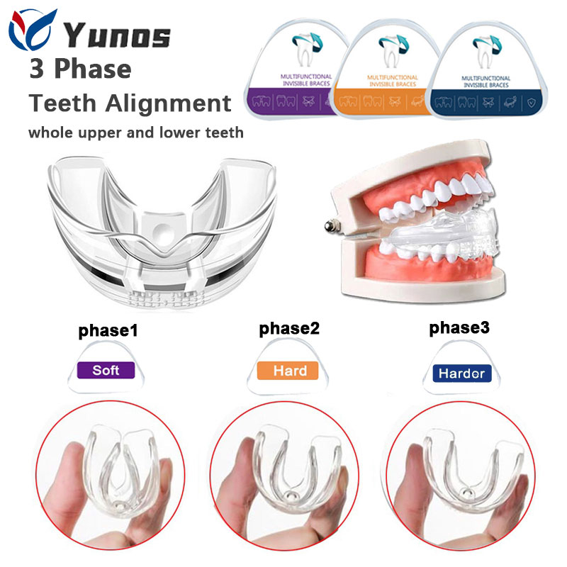 Yunos Dental Tooth Orthodontic Appliance Teeth Alignment Invisible