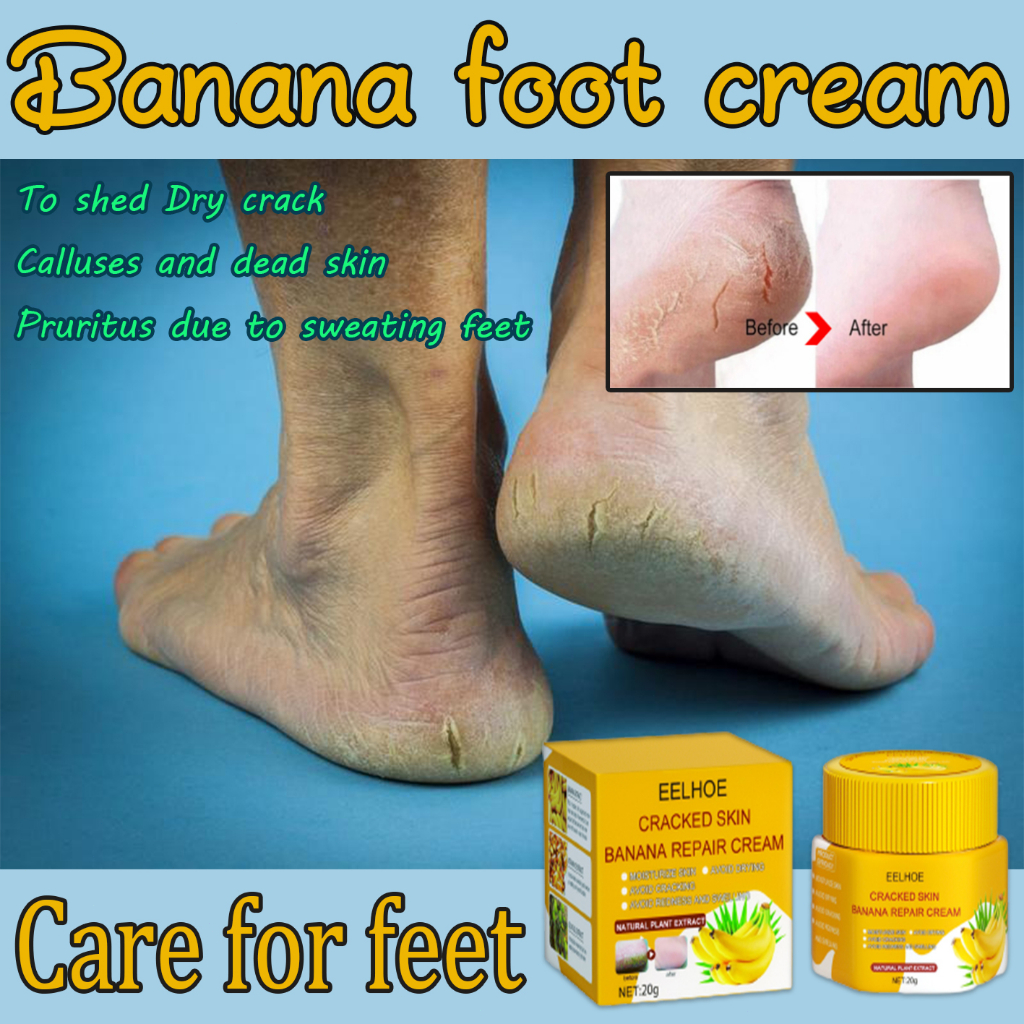 50g Foot Cream Dead Skin Remover Foot Crack Cream Foot moisturizing ...