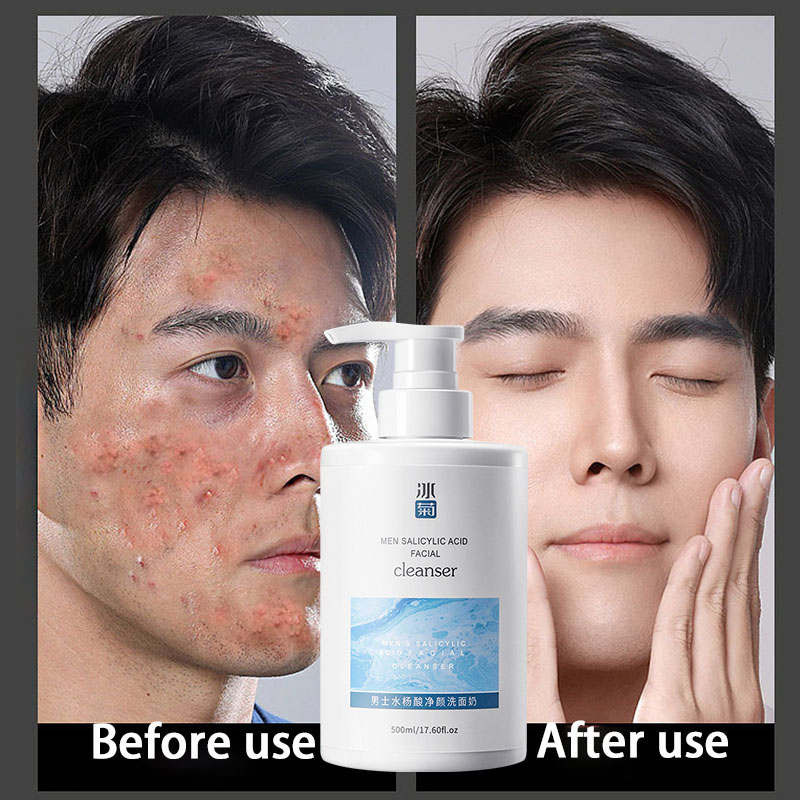 men facial wash salicylic acid cleanser Acne oily skin blackhead