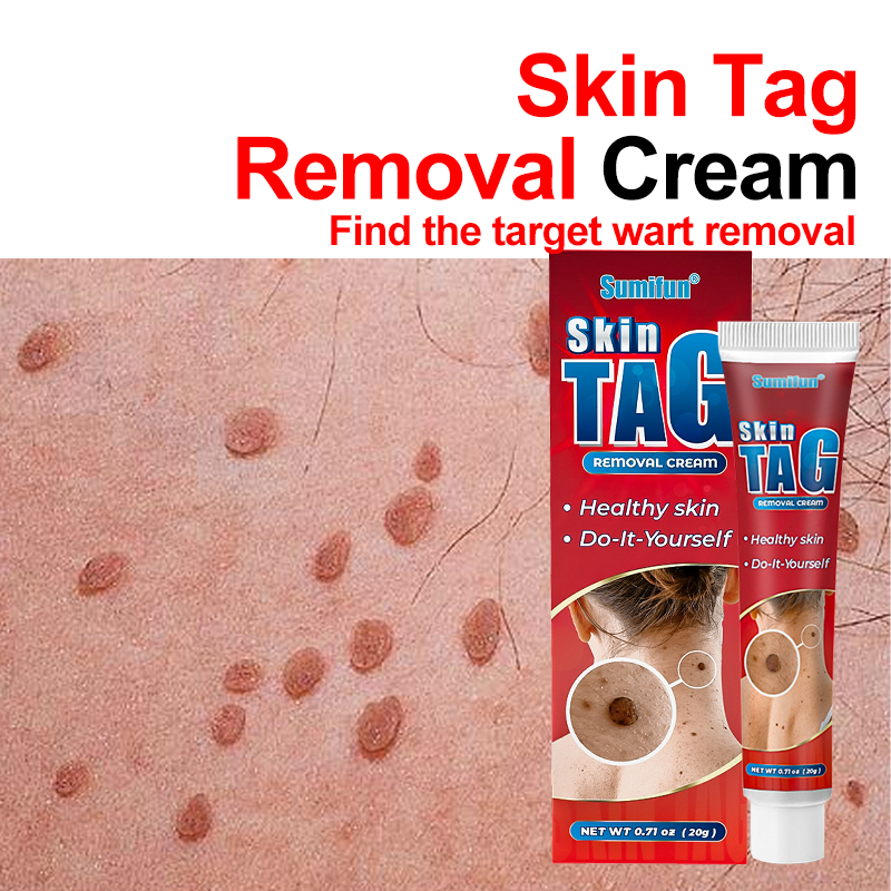 【Wart Removal Killer】Kulugo Remover Original Corn Remover Cream Plantar