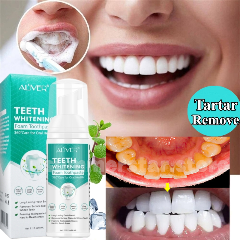 ALIVER Teeth Whitening Mousse Toothpaste Remove Tartar Cleansing Plaque ...