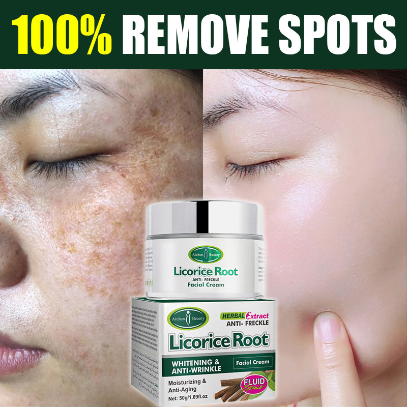 Licorice Root Melasma cream Pekas Treatment Freckle Melanin Dark Spots