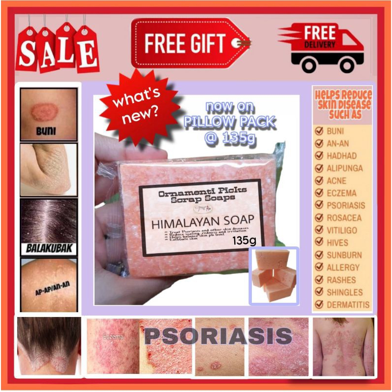 Antibungang araw soap/ prickly heat Rash Soap anti kati kati,allergic