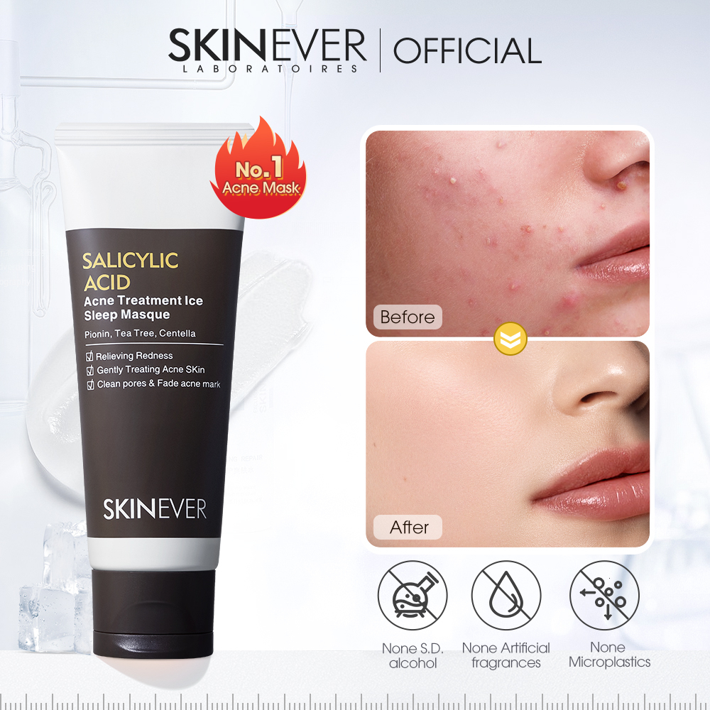 SKINEVER Salicylic Acid Pimple Remover Acne Treatment Ice Sleep Masque