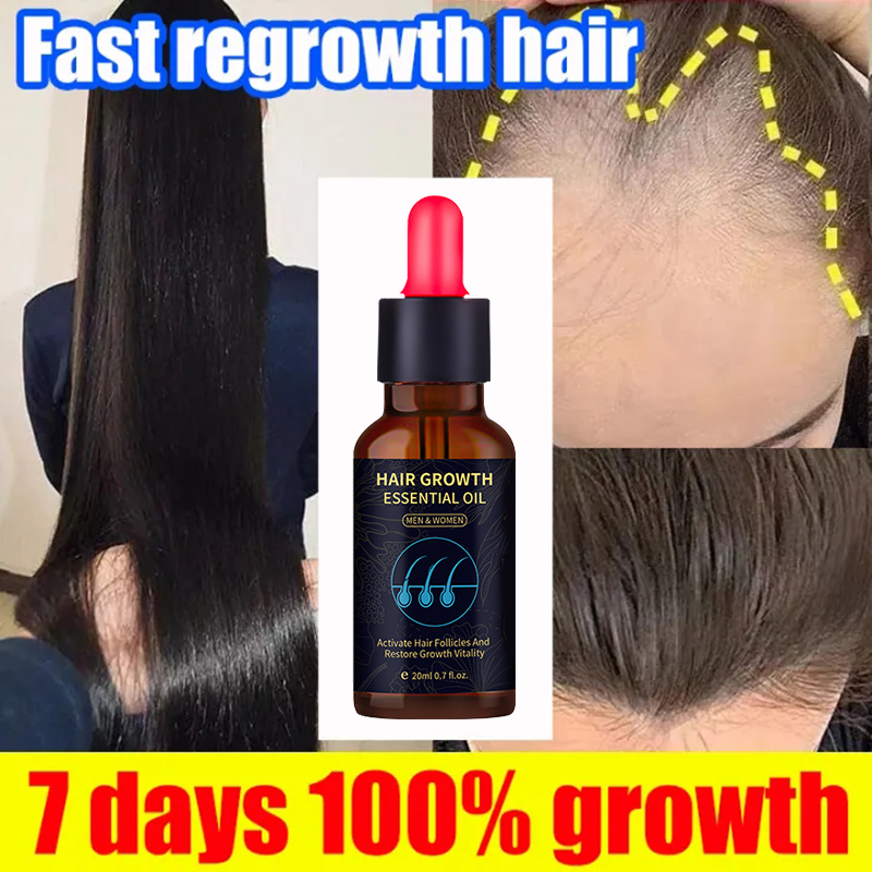 Minoxidil Hair Growth Serum Ginger Hair Grower Essential Oil Anti Hair ...