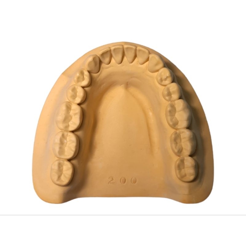 LOWER ONLY Edentulous and Dentulous Ideal Cast Shopee Philippines